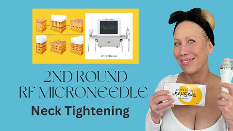 Neck Tightening with RF Microneedling - Plasma Perfecting