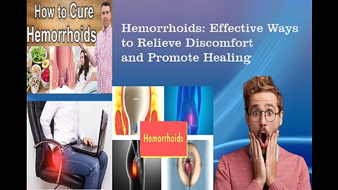 Hemorrhoids Effective Ways to Relieve Discomfort and Promote Healing