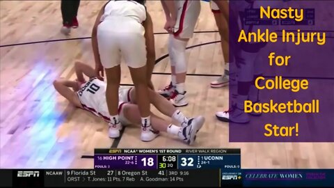Nasty Ankle Injury for College Basketball Star!