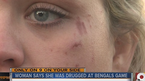 Woman claims she was drugged at Bengals game