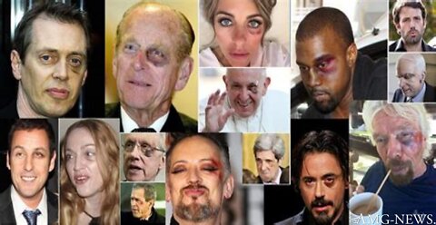 “Black Eye Club” Forever Victims Of The Globalist Cabal