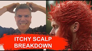 Itchy scalp breakdown