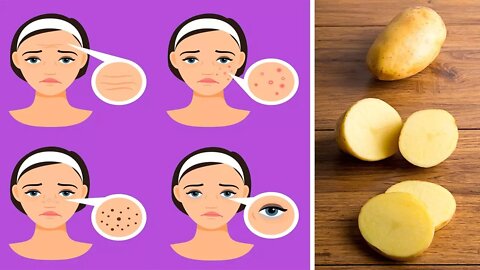 6 Clever Ways To Use Potatoes As A Beauty Product