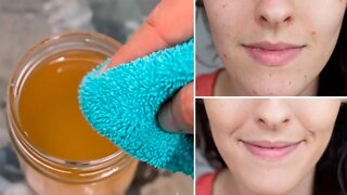 Why You Should Wash Your Face With Apple Cider Vinegar