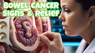 Recognizing Bowel Cancer: Signs, Symptoms, Treatment