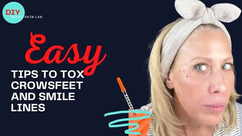 DIY Tox on Crowsfeet and Smile Lines Toxta @ Estaderma SASSY15 saves 15%