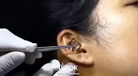 LIZARD CRAWL INTO WOMAN’S EAR👨‍⚕️🦎👂👀👂💫