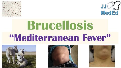 Brucellosis (Mediterranean Fever) | Transmission, Pathogenesis, Symptoms, Diagnosis, Treatment