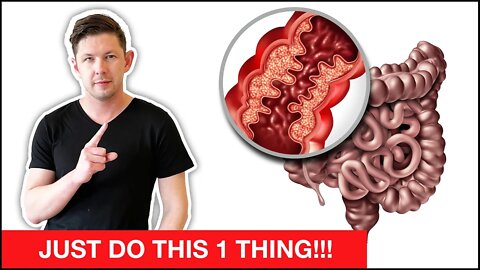 💩The 1st & Most IMPORTANT STEP to Heal CROHN'S DISEASE!