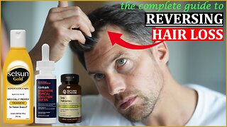 E86 - Here's The BEST Way To Prevent Hair Loss