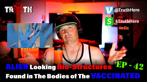 The Uncensored TRUTH - 42 - Alien Looking Bio Structures Found in the Bodies of Vaccinated People!