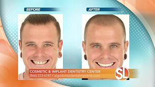 Dr. Jose Valenzuela of Cosmetic & Implant Dentistry Center can help you get the smile you want!