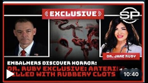 Embalmers Discover Horror: Dr. Ruby Exclusive: Arteries Filled With Rubbery Clots