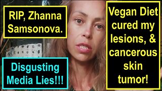 Zhanna Samonova drank no water for 6 years!!!! Vegan diet cured my lesions, & cancerous skin tumor!