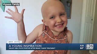Valley girl inspires others after brain tumor treatment