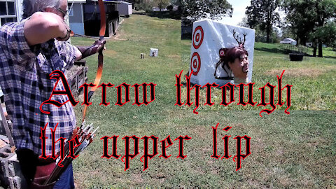 Arrow through the upper lip