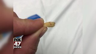 Woman finds human tooth in a bag of cashews