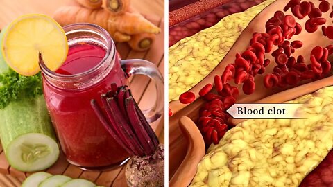 Drink A Glass Of This Juice Every Morning To Cleanse Your Arteries
