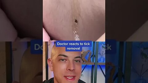 Doctor reacts to odd tick removal! #tick #dermreacts #oliveoil