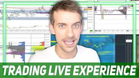 Trading Live Experience using Volume Profile: $562 Profit