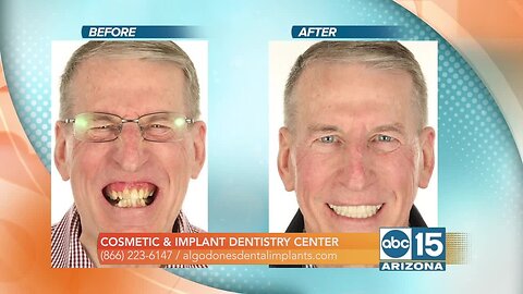 Cosmetic & Implant Dentistry Center wants to help you get the perfect smile!