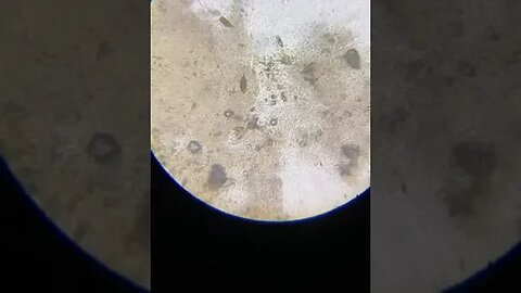 A dog's saliva under a microscope