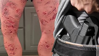 Dog Attacks and Concealed Carry