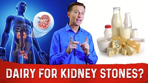 Should You Eat Dairy (Calcium) With Kidney Stones? Food For Kidney Stones – Dr. Berg
