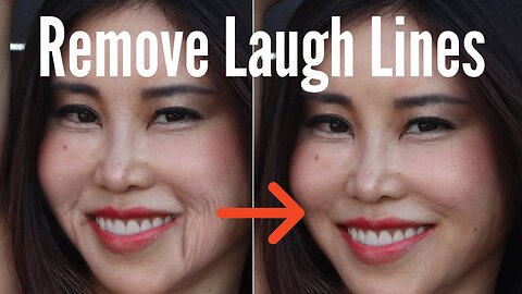 Remove Laugh Lines