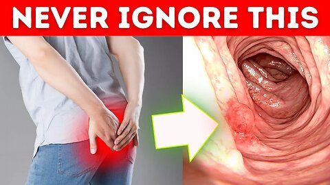 Never Ignore These Signs of Colon Cancer
