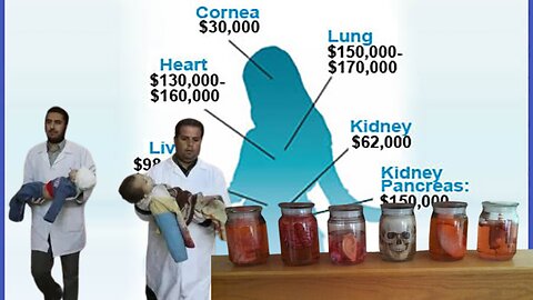 Organ Harvesting in Gaza by ✡️ Israelis