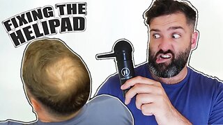 HOW TO FIX A BALD SPOT | Fixing the Heli-Pad with Hairporium hair Fibres