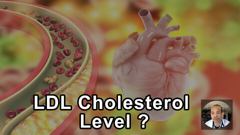 Should My LDL Cholesterol Level Be Lower Than 55? - Kim Williams, MD