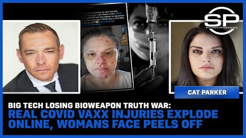Stew Peters: Big Tech Losing Bioweapon Truth War: Real Covid Vaxx Injuries EXPLODE online