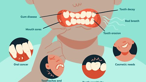 ProDentim Reviews - What is ProDentim? ProDentim Does it Work? ProDentim Dental Health