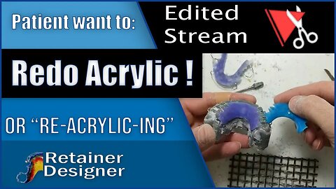 Live Stream Edited: "Re-Acrylic-ing" Patient wants to change the color!