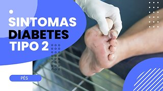 Sintomas Diabetes Tipo 2 [ Pés ]