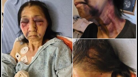 70-Year old attacked because Racist Black thought she was Asian