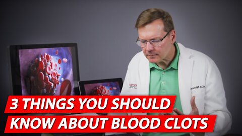 3 things you should know about BLOOD CLOTS