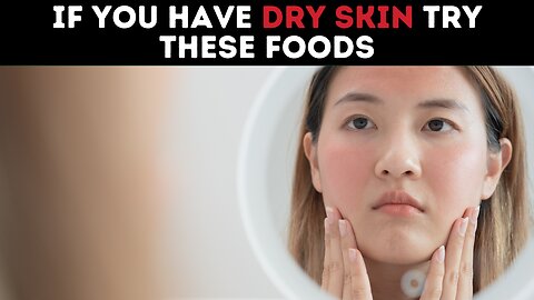 If You Have Dry Skin Try These Foods