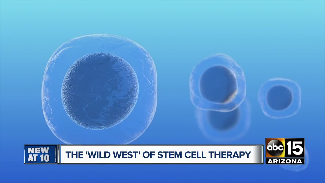 The 'Wild West' of stem cell therapy