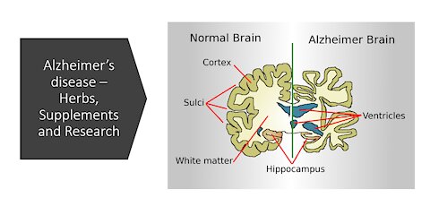 Alzheimers disease - herbs, supplements & nutrients