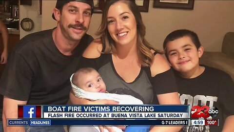 Boat fire victims recovering in burn center