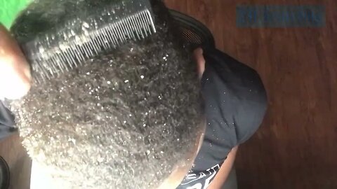 Snowy Dandruff Scratching