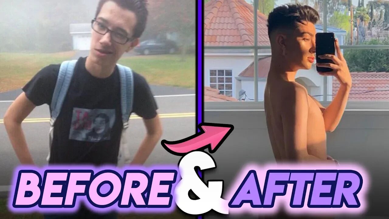 James Charles | Before and After | Butt Implants ? Plastic Surgery Rumours  & more