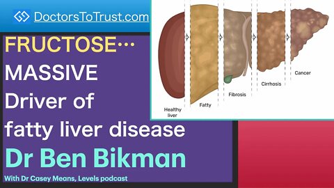 BEN BIKMAN 5 | FRUCTOSE…MASSIVE Driver of fatty liver disease