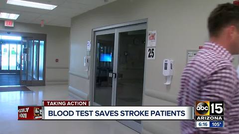 Blood test saving stroke patients in Arizona