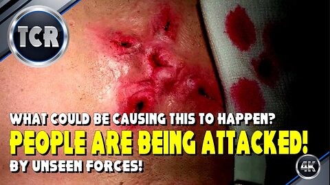 People Are Being Attacked by Unseen Forces. What Could Be Doing This?