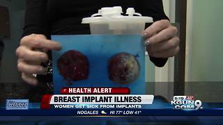 South Florida woman: Breast implants ruined my life