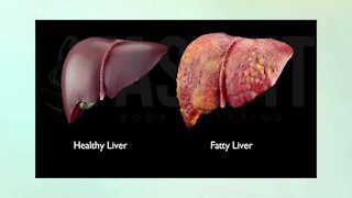 Weight and Your Liver